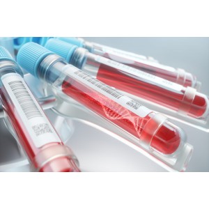 cfDNA 分离实验室服务